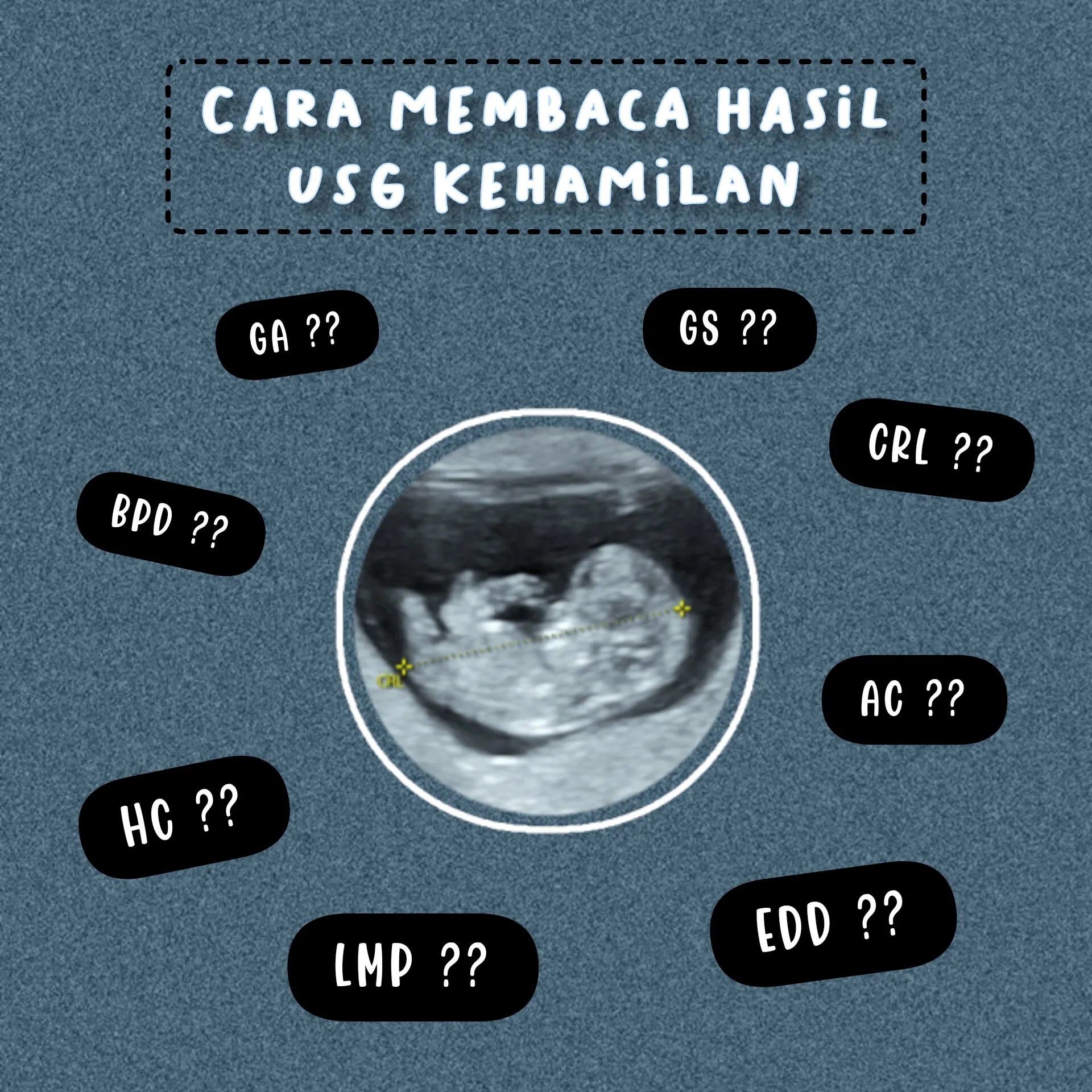 Cara Membaca Hasil USG Kehamilan Galeri diposting oleh 𝓘𝓼𝓷𝓪𝓡𝓸 Lemon8