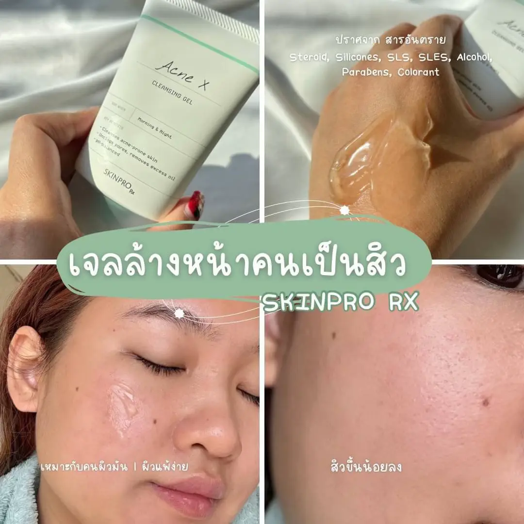 คนเปนสวตองตวน SKINPRO Rx Acne X Cleansing Gel แกลเลอรทโพสต