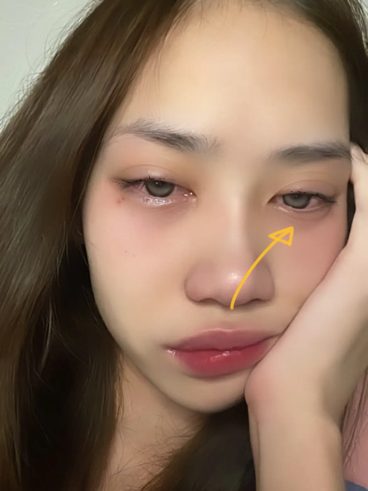 HOWTO Minus Under Swollen Eyes🥺 | Gallery Posted By SAKUNIT | Lemon8