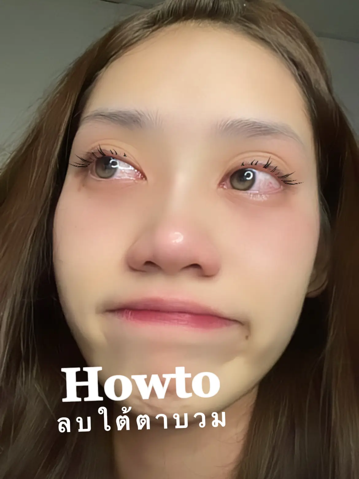 HOWTO minus under swollen eyes🥺 | Gallery posted by SAKUNIT | Lemon8