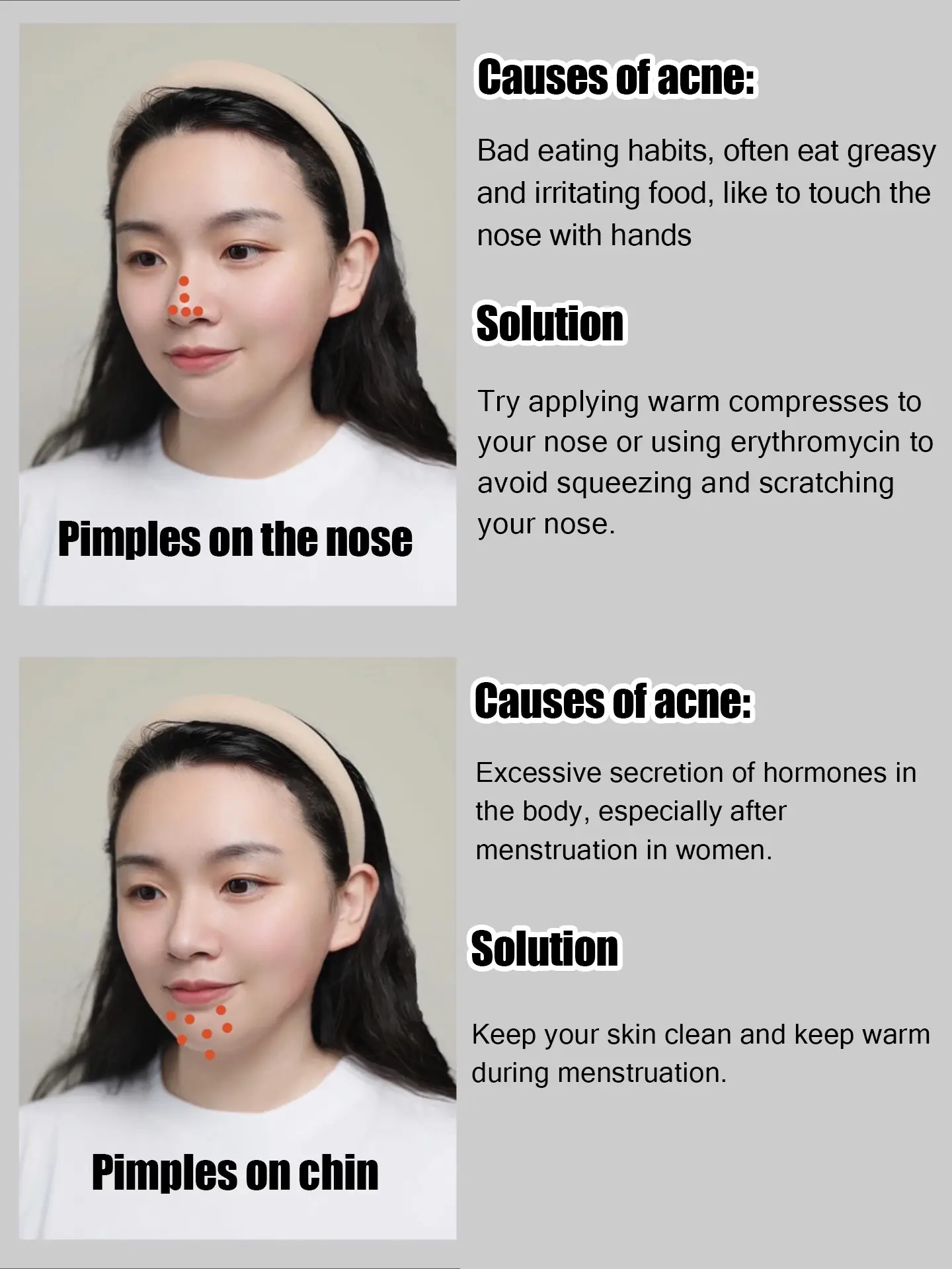 🌼🌼 Skincare routine when you have acne🌼🌼's images(3)