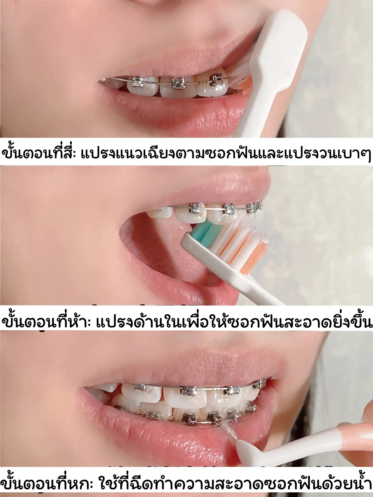 วิธีทำให้ฟันขาว ขึ้น แบบง่ายๆ ด้วยเบกกิ้งโซดา! ทำได้ที่บ้าน | แกลเลอรี ...