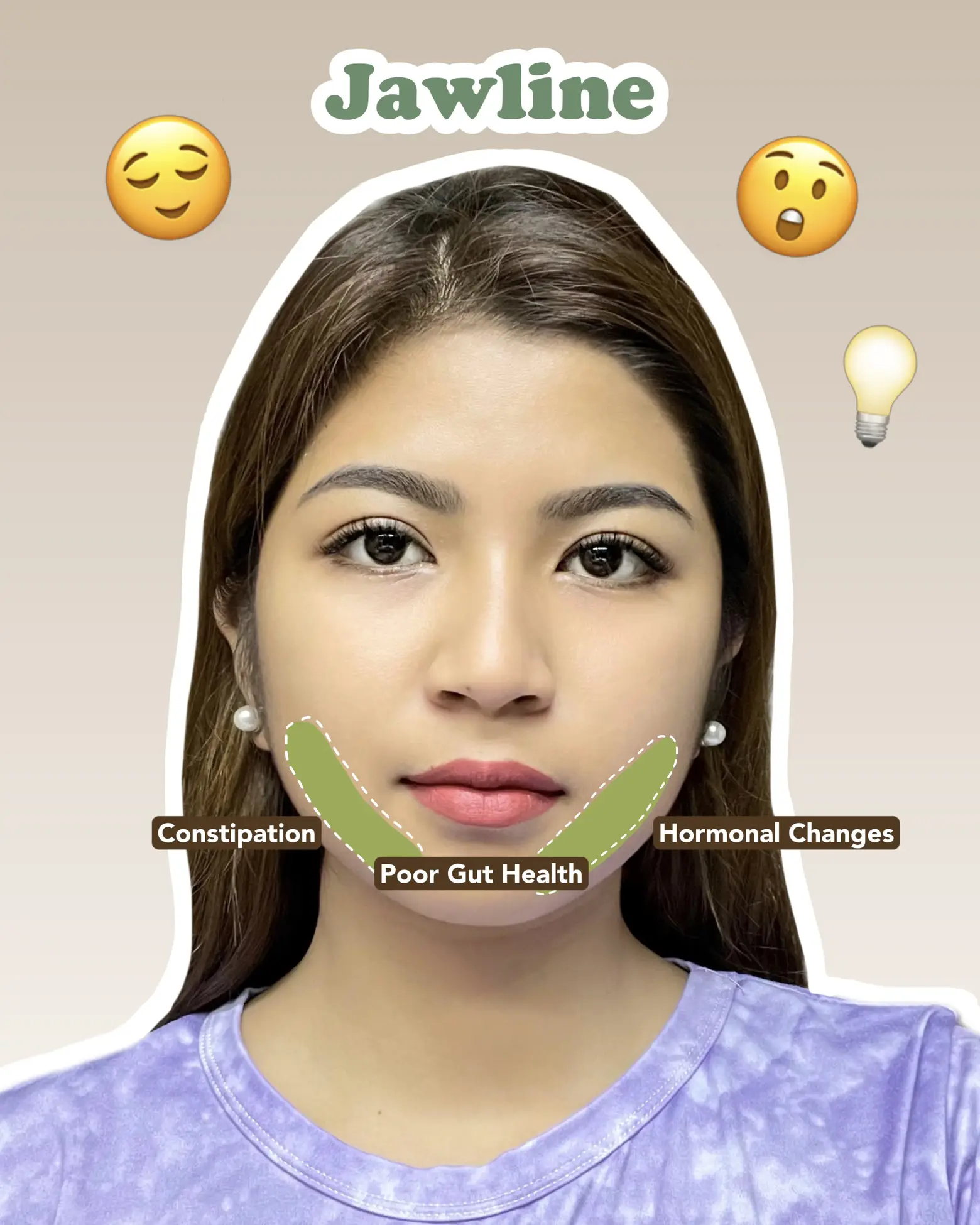 acne-face-map-what-causes-your-acne-gallery-posted-by-sandra-lemon8