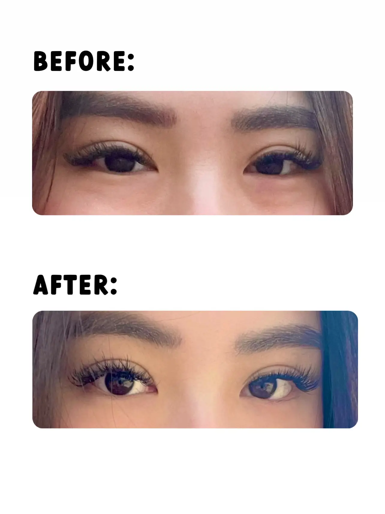 How I got rid of my EYE BAGS FAST! 's images(1)