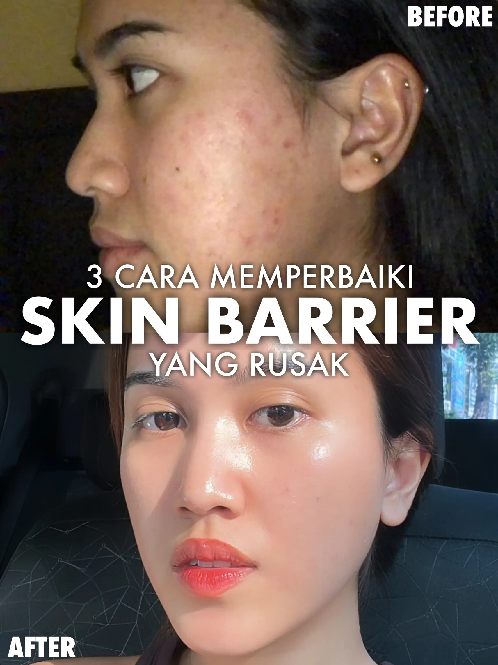 3 CARA MEMPERBAIKI SKIN BARRIER YANG RUSAK | Galeri Diposting Oleh ...