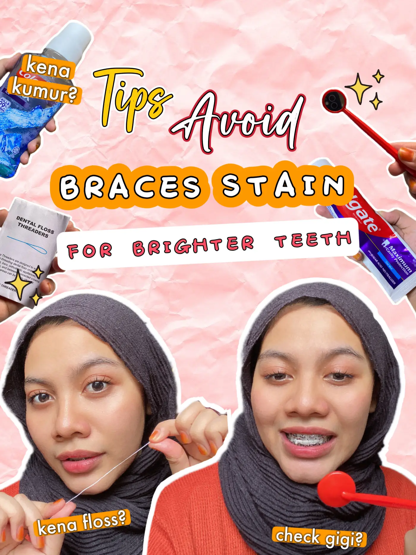 ‼️Rahsia Gigi Putih Kalau Pakai Braces‼️ | Galeri Disiarkan Oleh ...