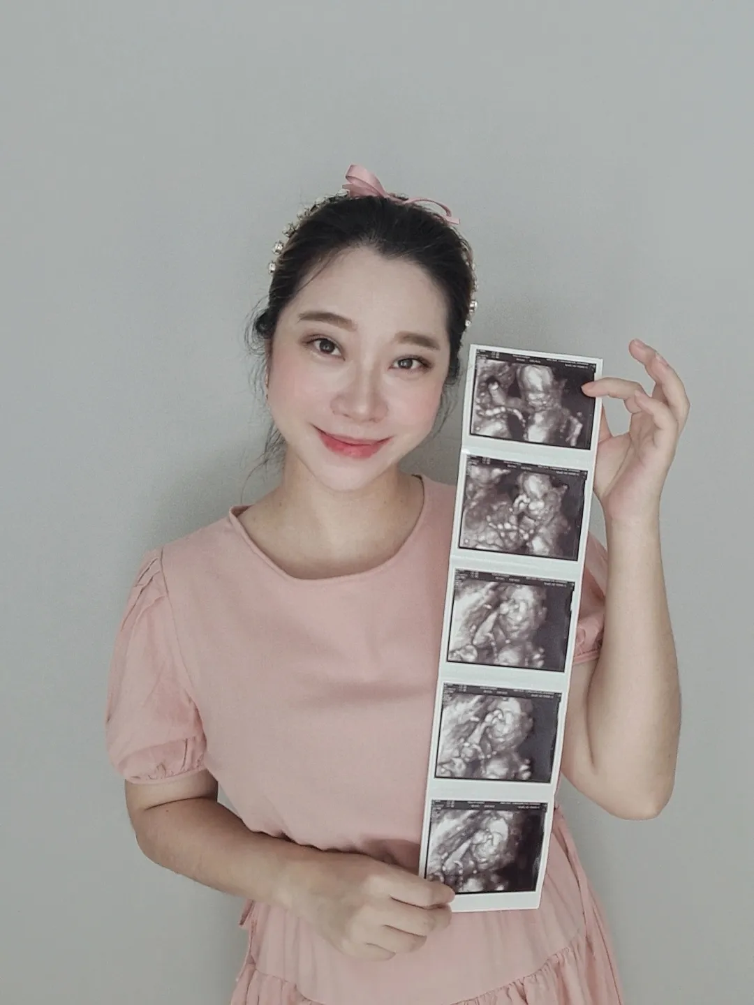 Share Experience Icsi 3rd Cycle Miracle Gallery Posted By Prodmamy share-experience-icsi-3rd-cycle-miracle-gallery-posted-by-prodmamy