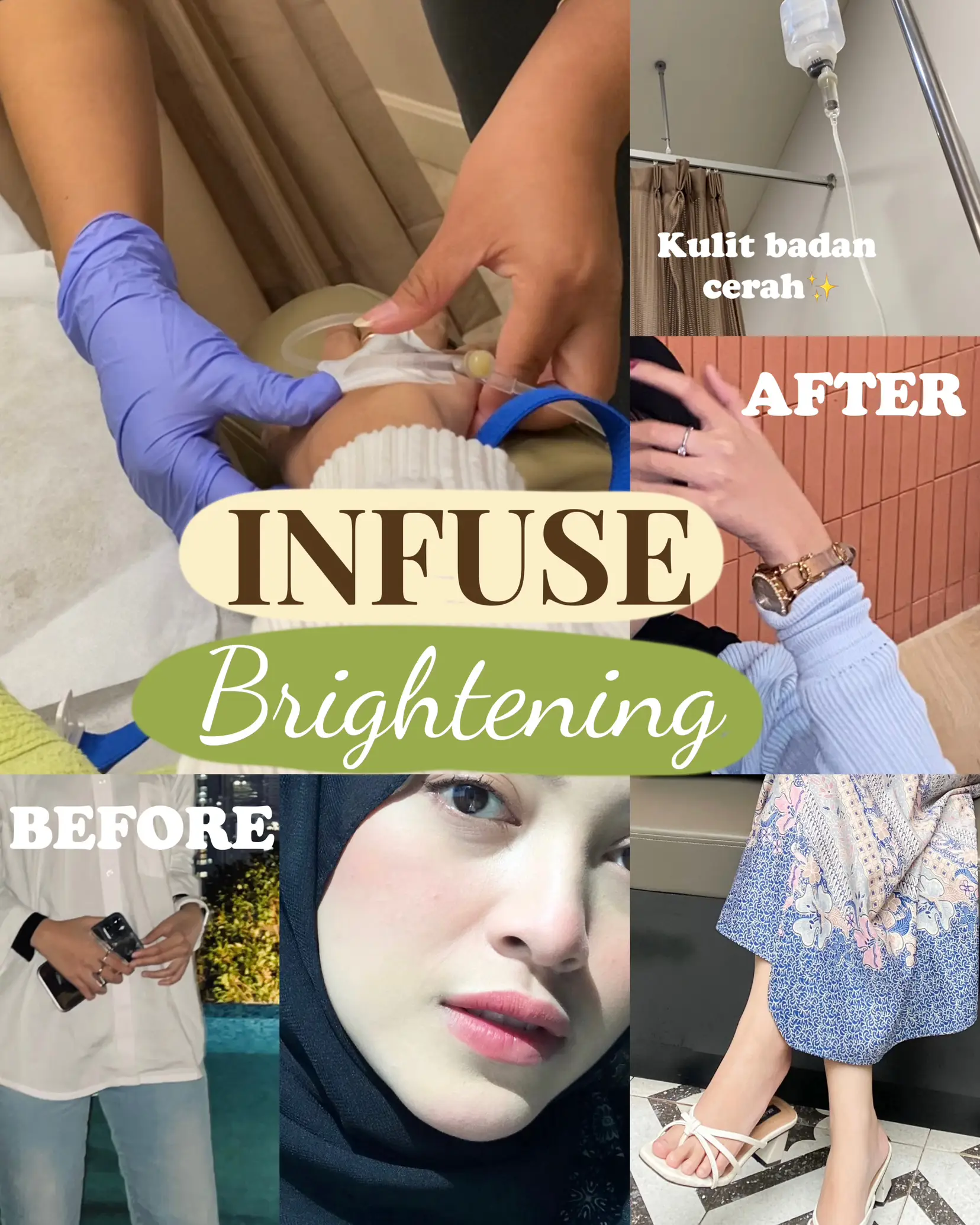 Drip Whitening Injection Kuching Carian Lemon8