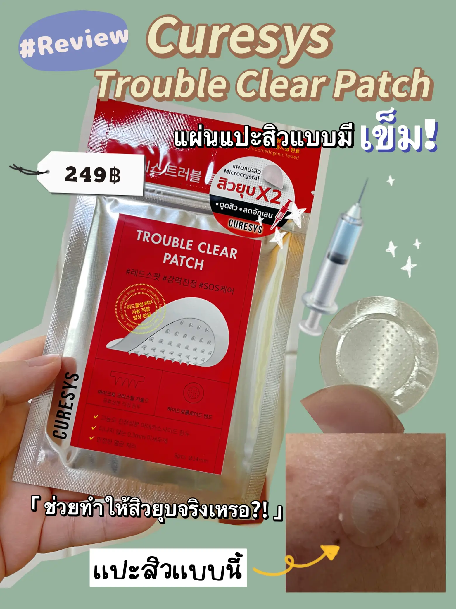 Curesys Trouble Care Patch Needled Acne Patch Review 💉 Gallery posted
