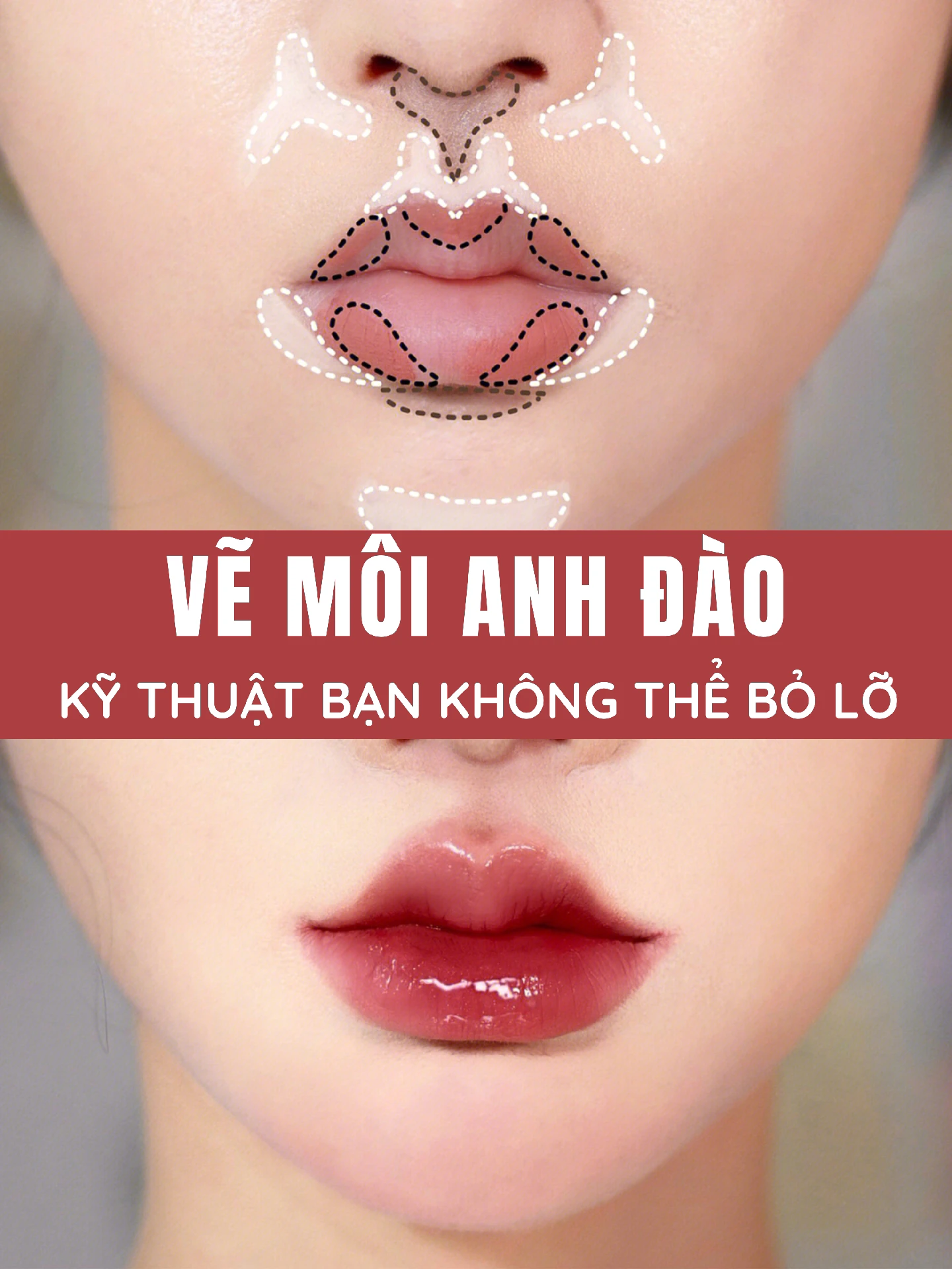 Tổng quan về Miệng Anh Đào