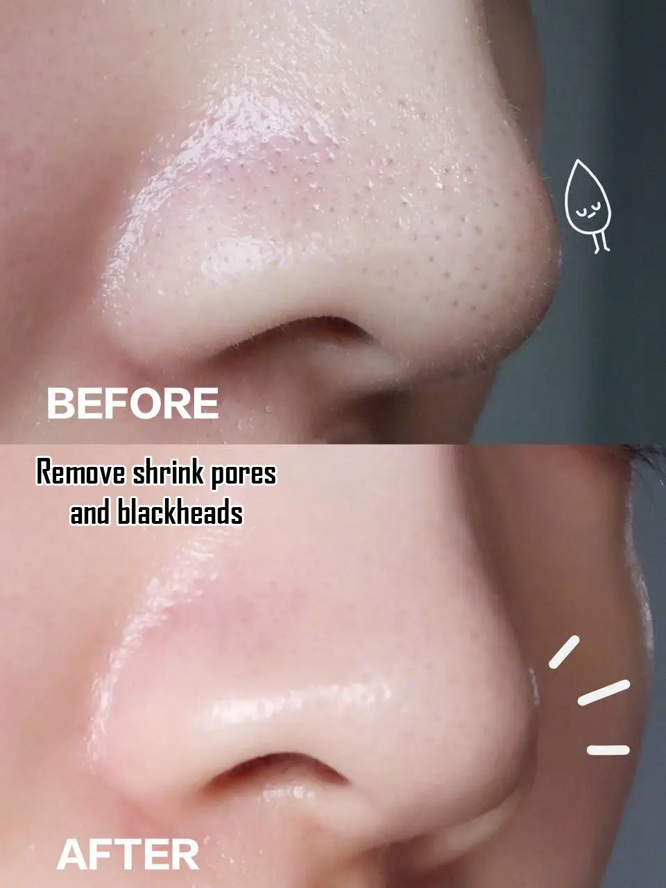Get rid of blackheads and shrink pores 📝's images(0)