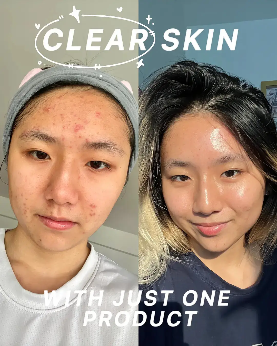 clear skin with just one product  🧖🏻‍♀️💗's images(0)
