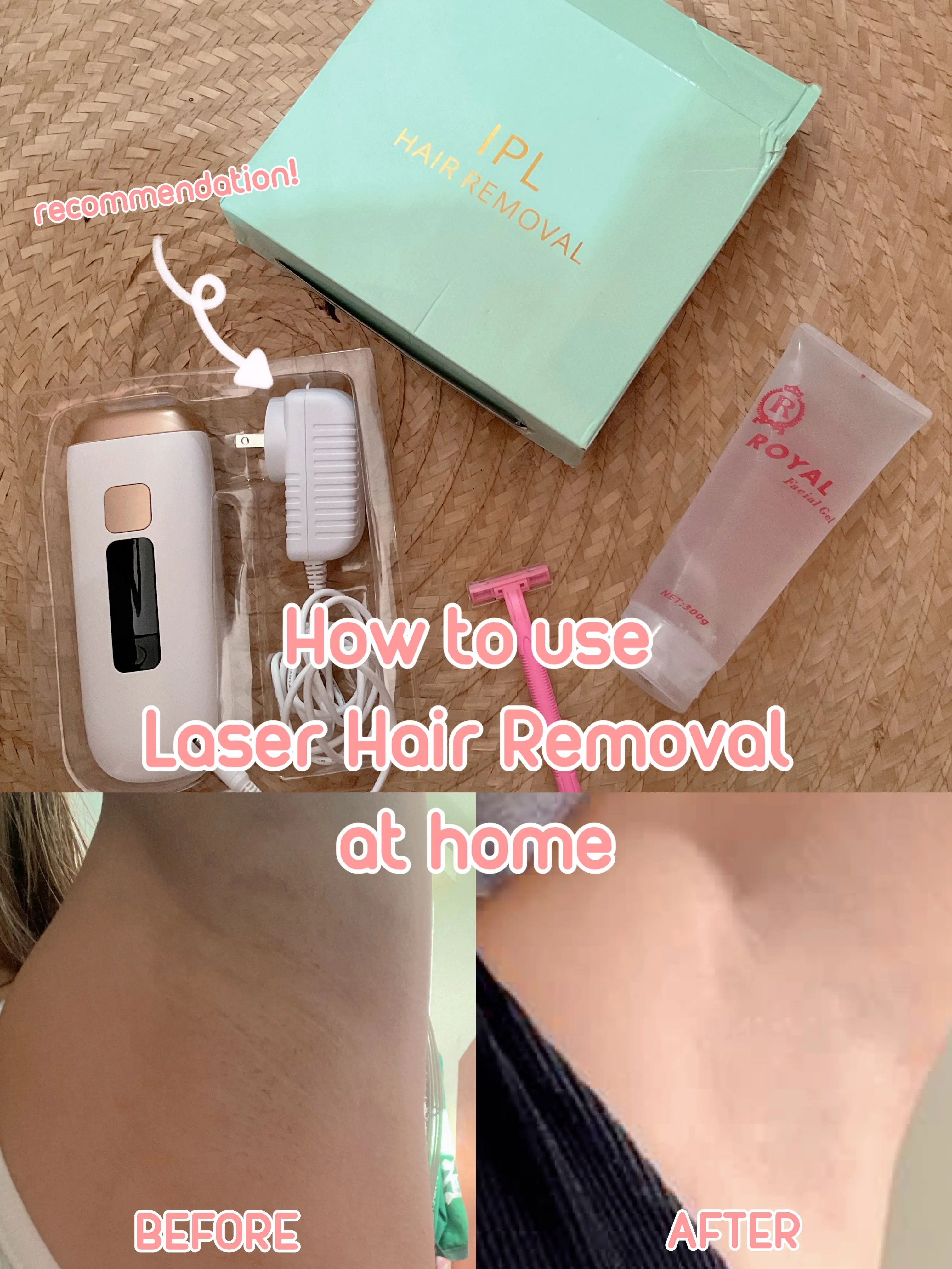 20 top At Home Ipl Kit for Hair Removal ideas in 2024