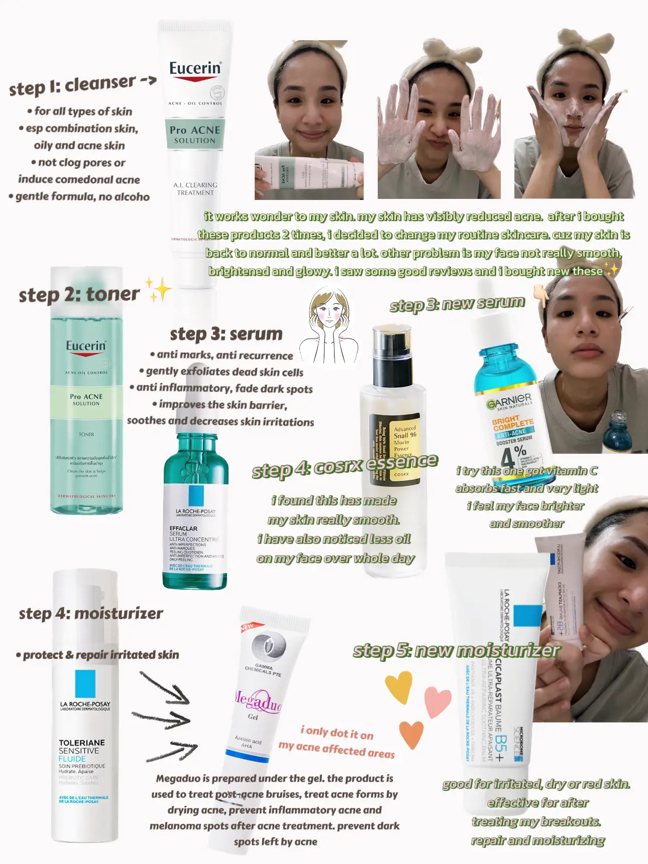 How i cleared my acne ❌❌❌ 🥹🥹🥹's images(1)