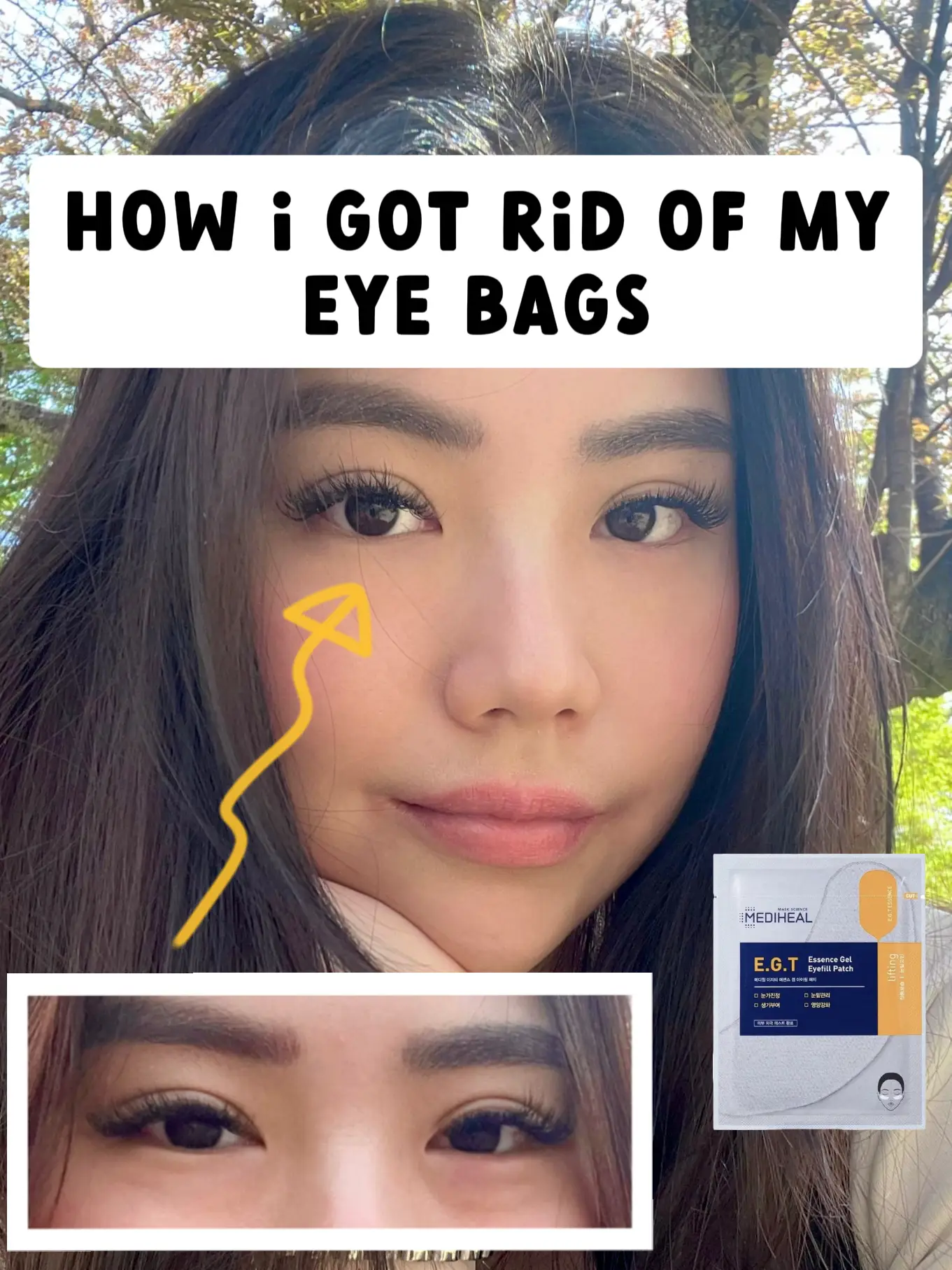 How I got rid of my EYE BAGS FAST! 's images(0)