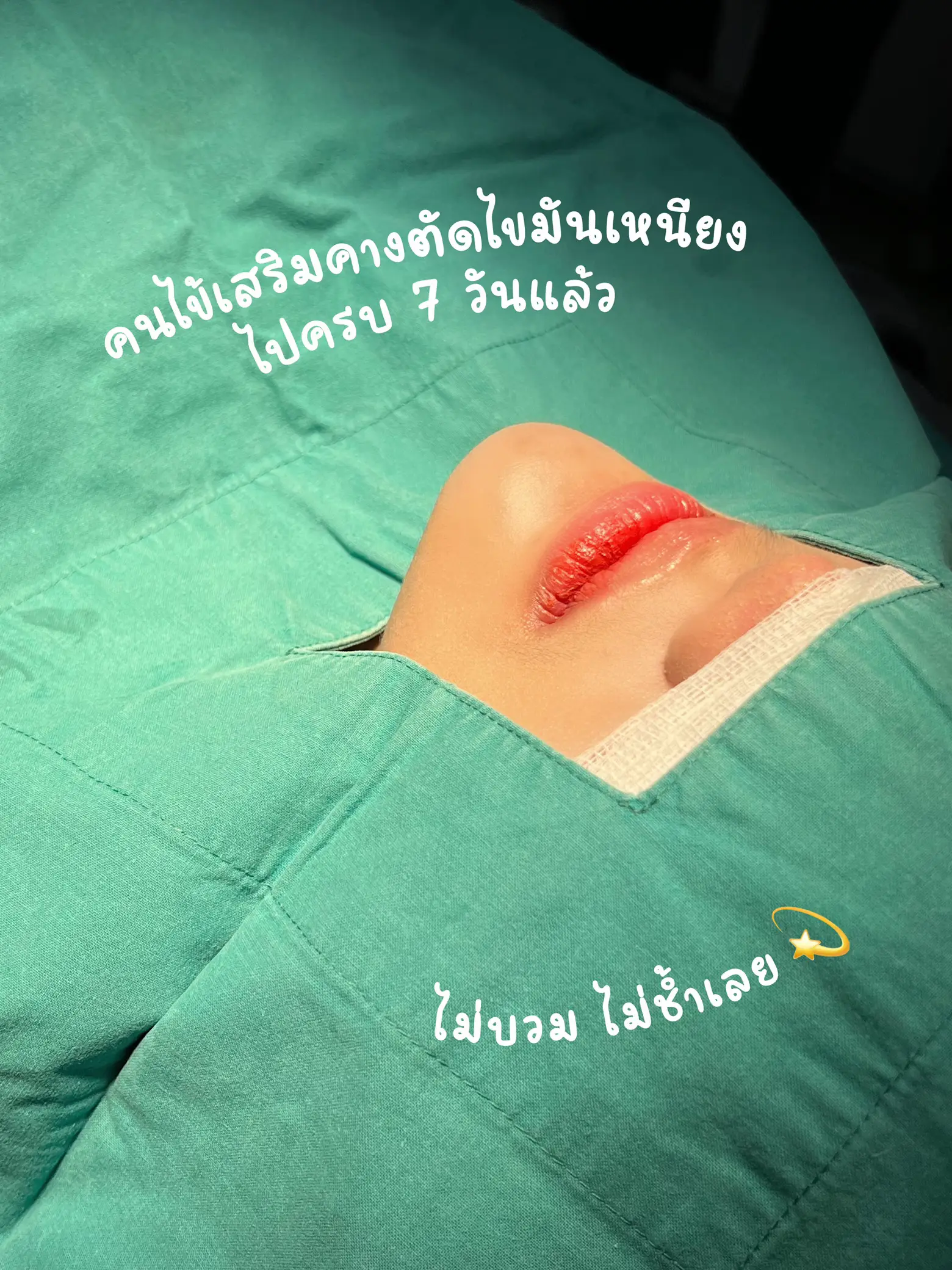 Update!! Extra chin wound for 7 days 💫 | Gallery posted by WE Clinic |  Lemon8