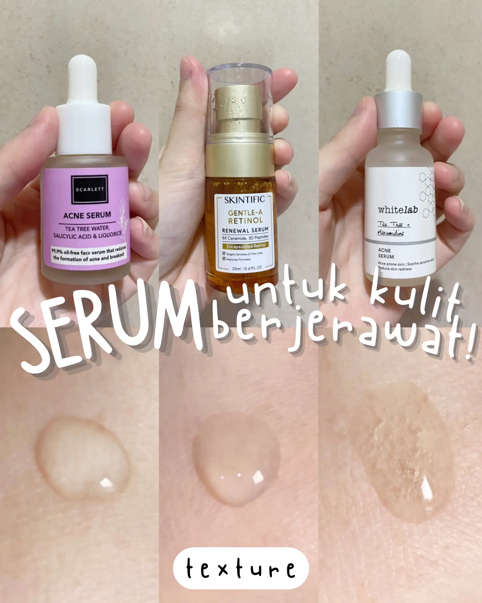 SERUM ACNE PRONE SKIN KULIT BERJERAWAT Gallery posted by tirza