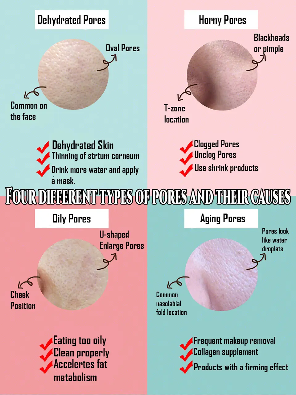 Four different types of pores and their causes💜's images(0)