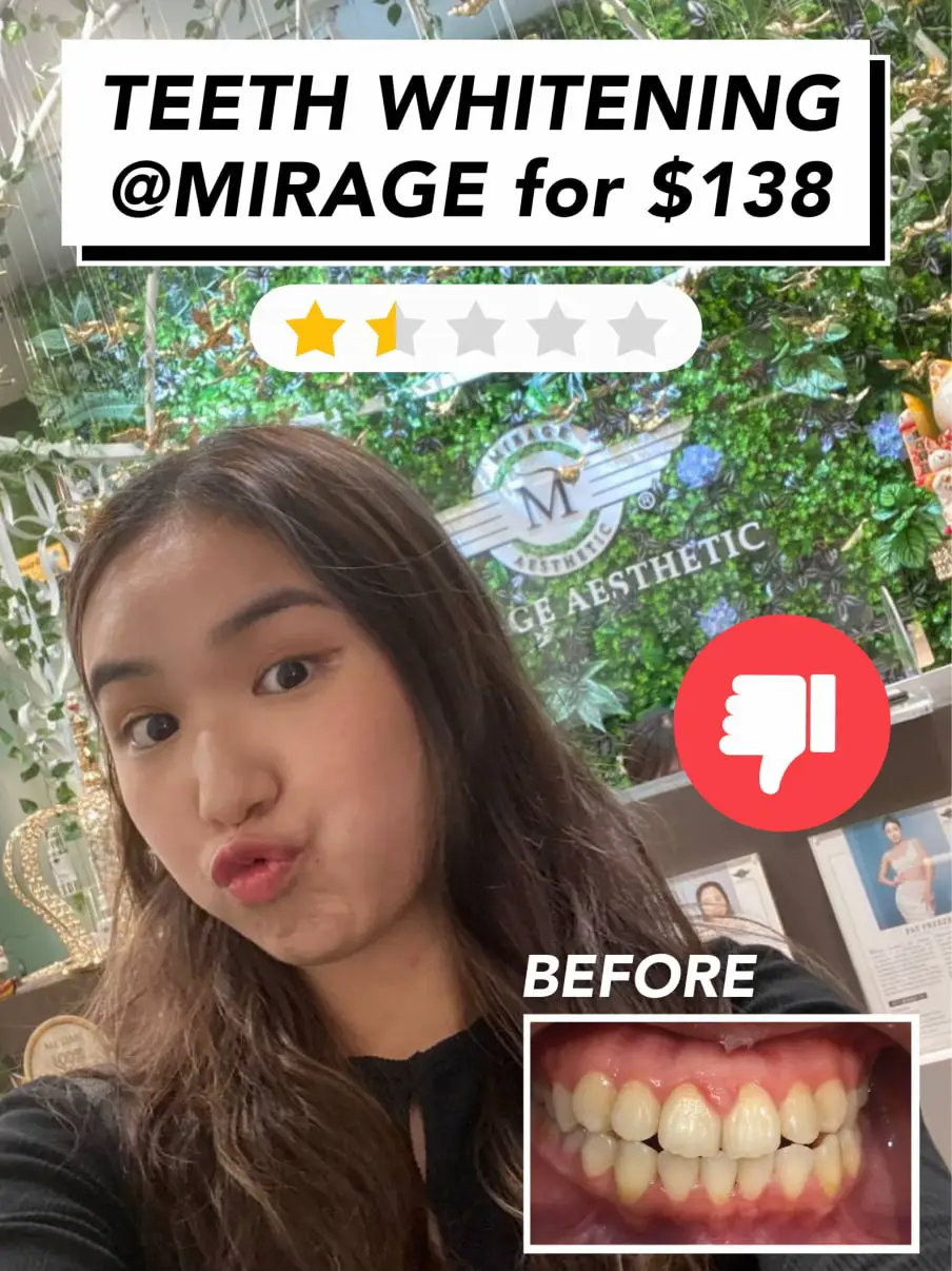 Beauty My Experience at Mirage Aesthetics Gallery posted by