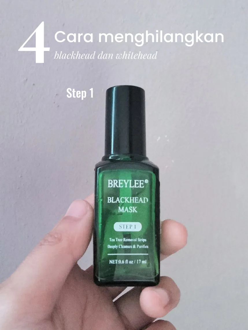 Langkah Elak Whiteheads Muncul Semula