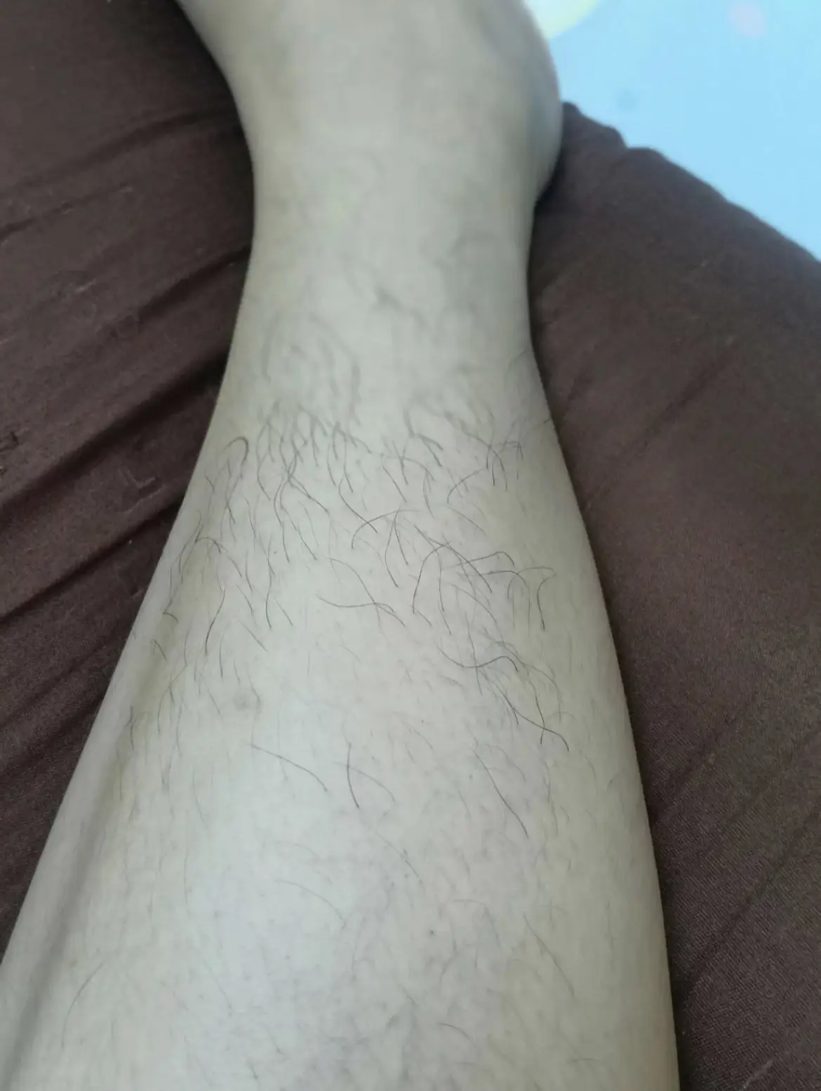 รีวิวครีมกำจัดขน Mimikos Body Hair Remover Cream (Norma แกลเลอรีที่