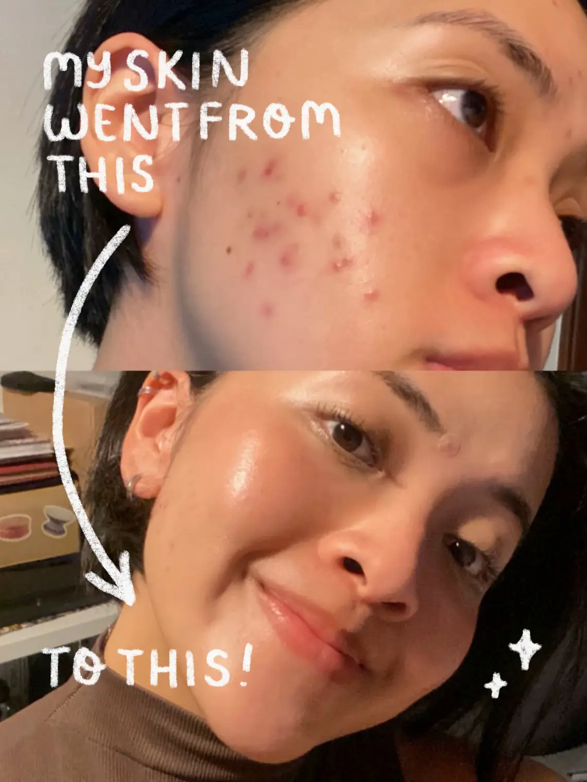 3 products that truly TRANSFORMED my skin in 2022's images(0)