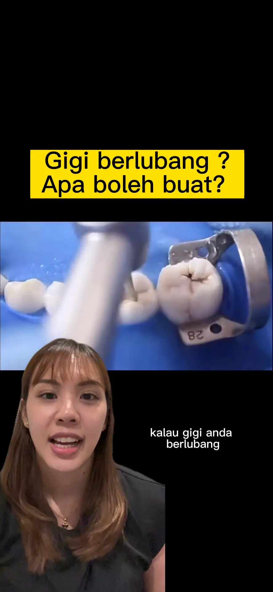 Gigi Berlubang?