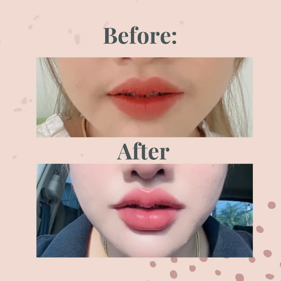 Seoul Face Clinic บางใหญ่ การค้นหาใน Lemon8