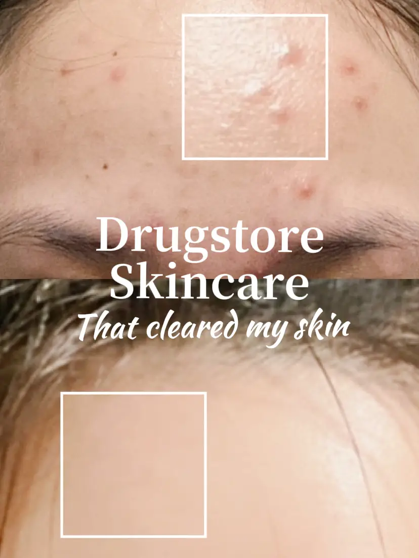 ✨ Holygrail skincare THAT WORKS 🥰's images(0)