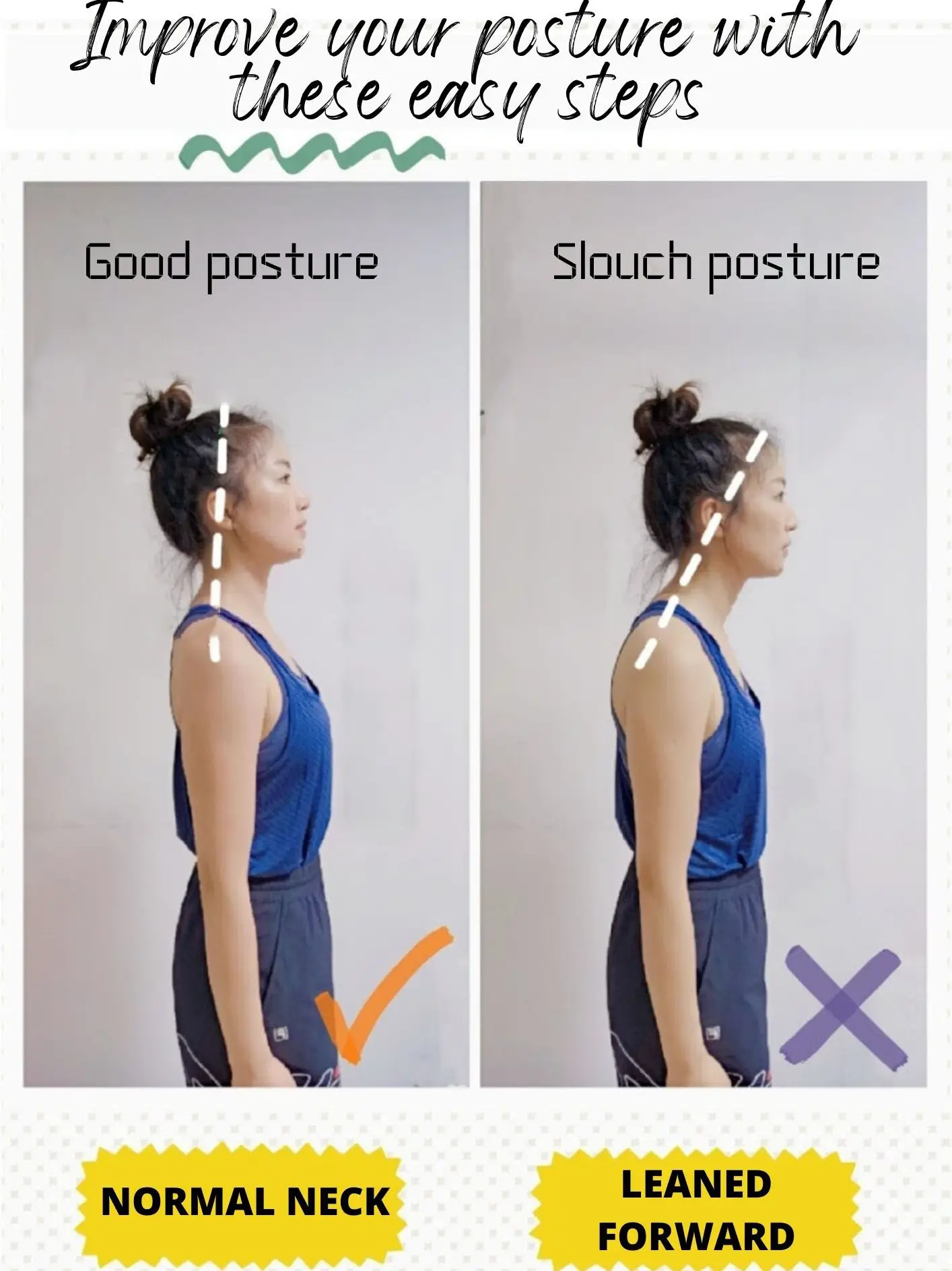 Best Posture Correction Treatment in Malaysia