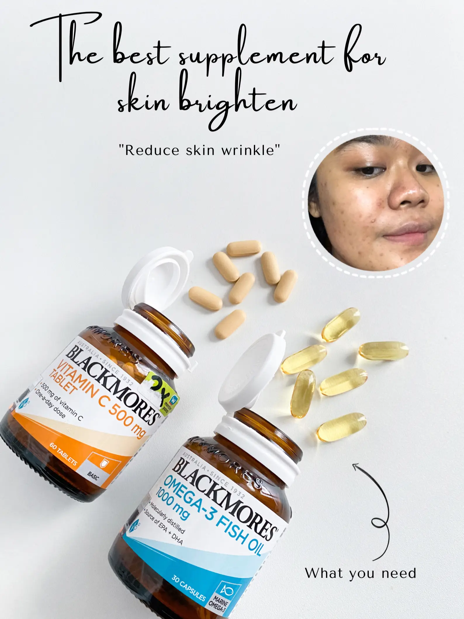 The Best Supplement for Skin Brighten Gallery posted by