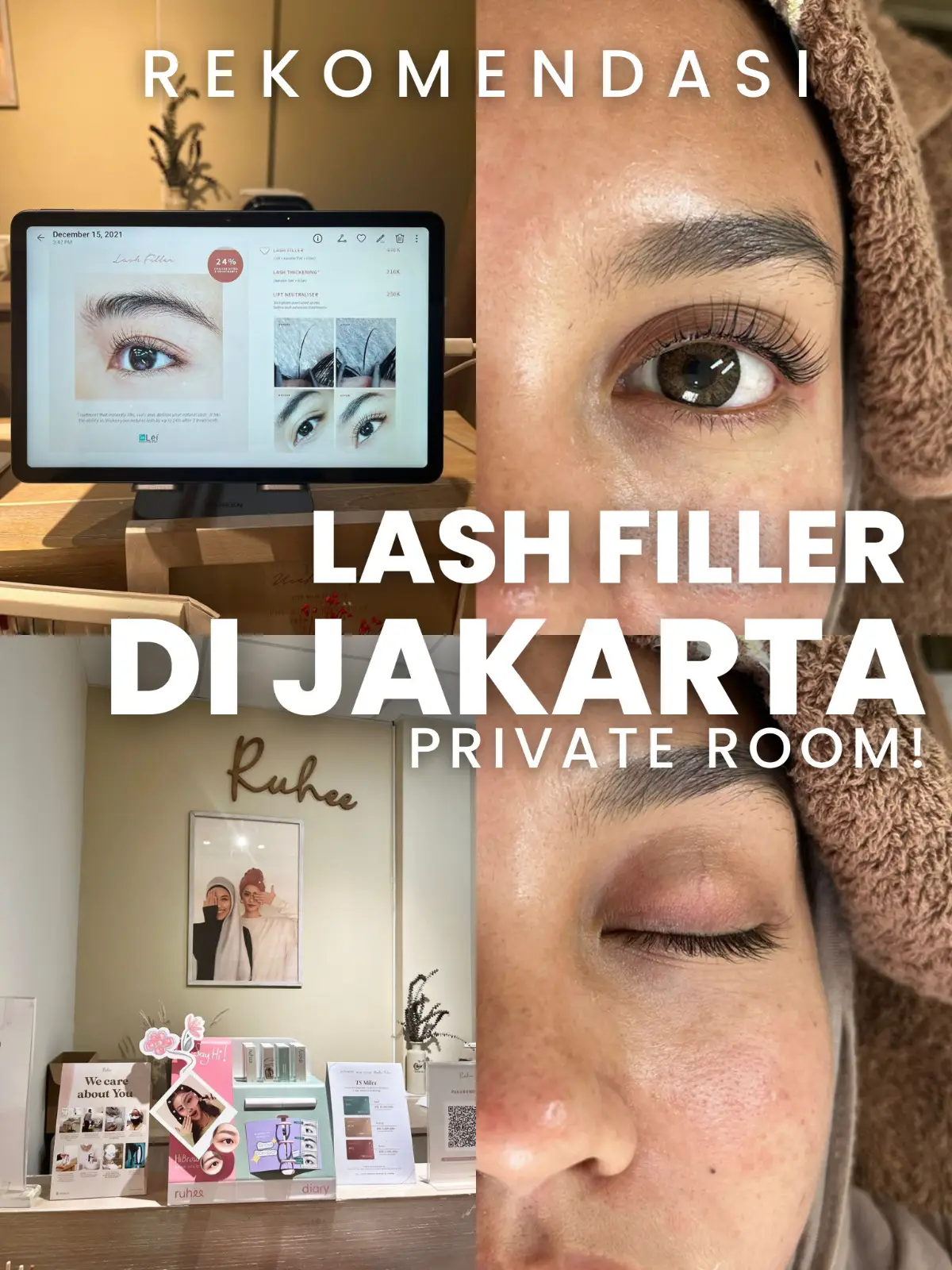 Rekomendasi lash filler dijakarta Private room! Galeri diposting oleh raamlpppp Lemon8 pic