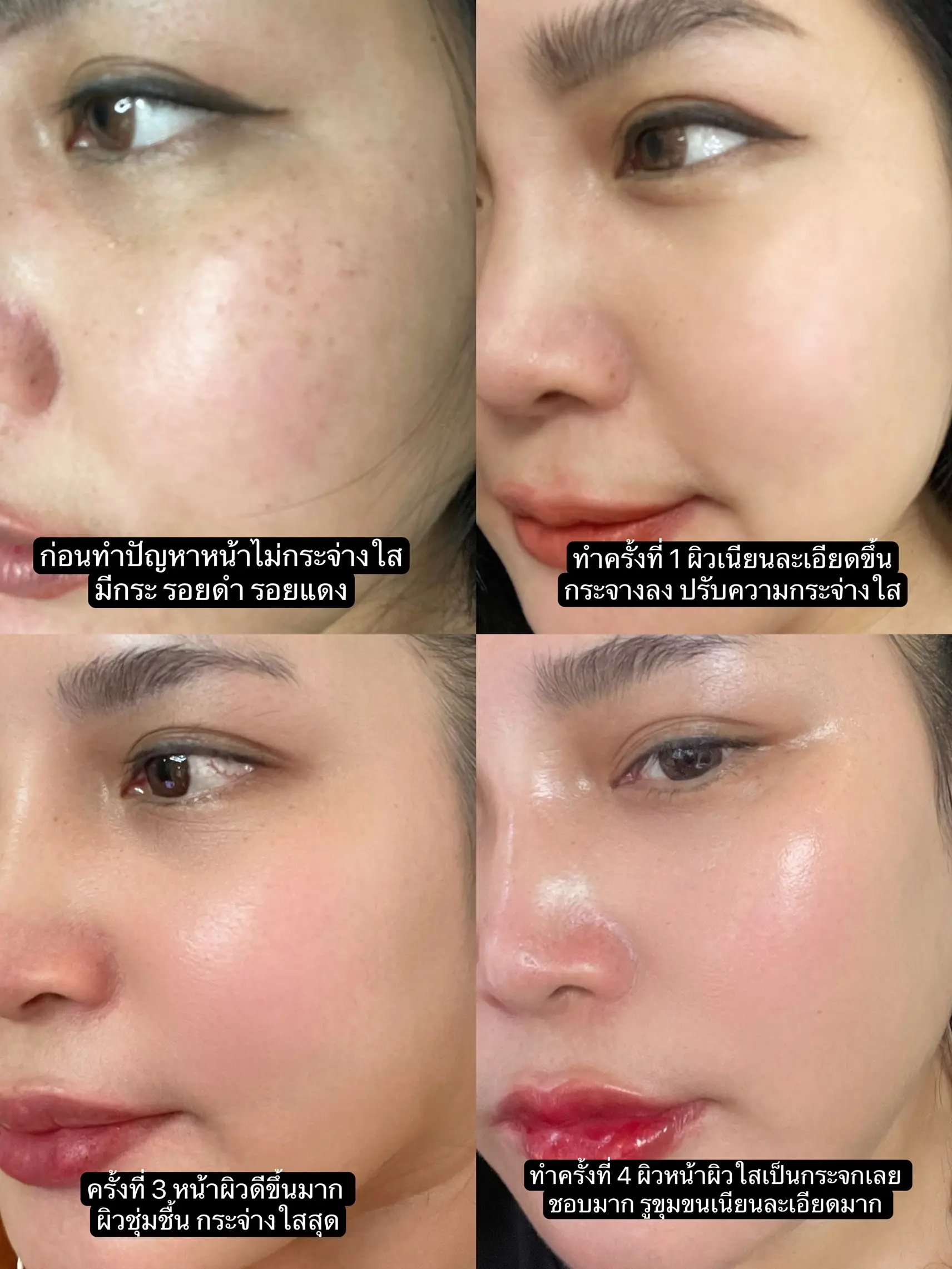 รีวิวเอง Pico หน้าใส หน้าเงาเป็นกระจก | แกลเลอรีที่โพสต์โดย Auichocky |  Lemon8