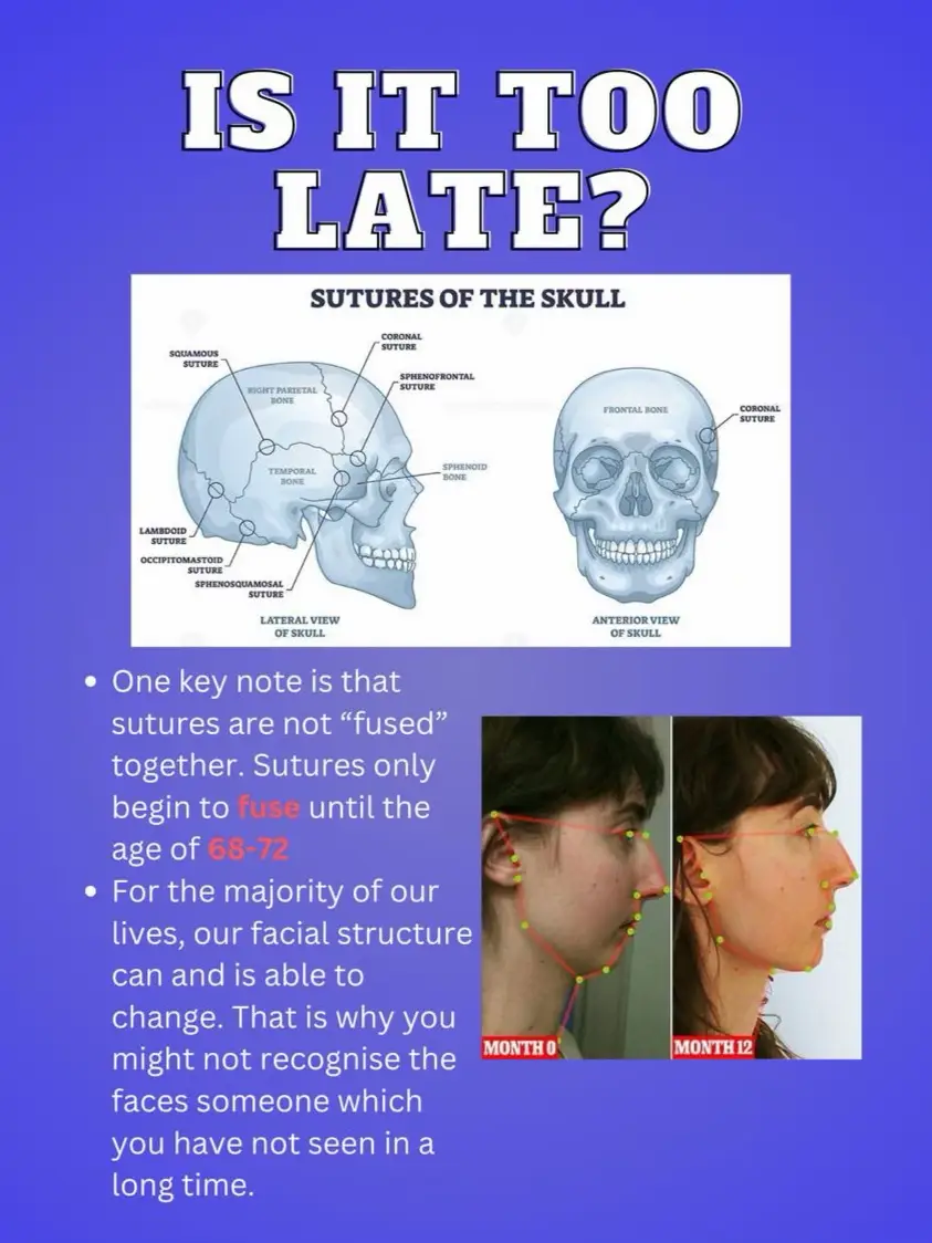 Mewing and Orthotropics: How to Change Your Facial Bone Structure