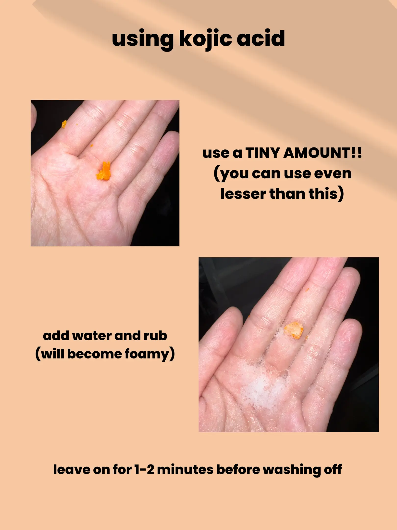 Using ACID SOAP for ACNE (my skincare journey)'s images(2)
