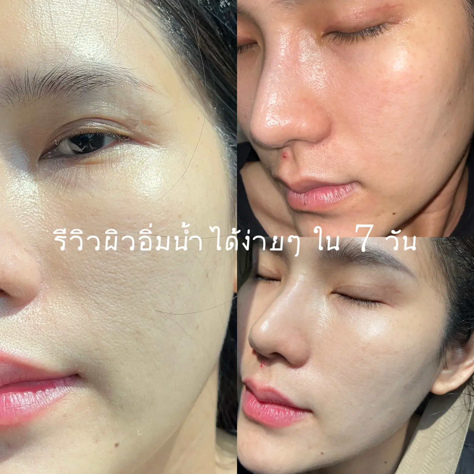 Clear Face review in 7 days with the famous Chanel, Gallery posted by  tomtam