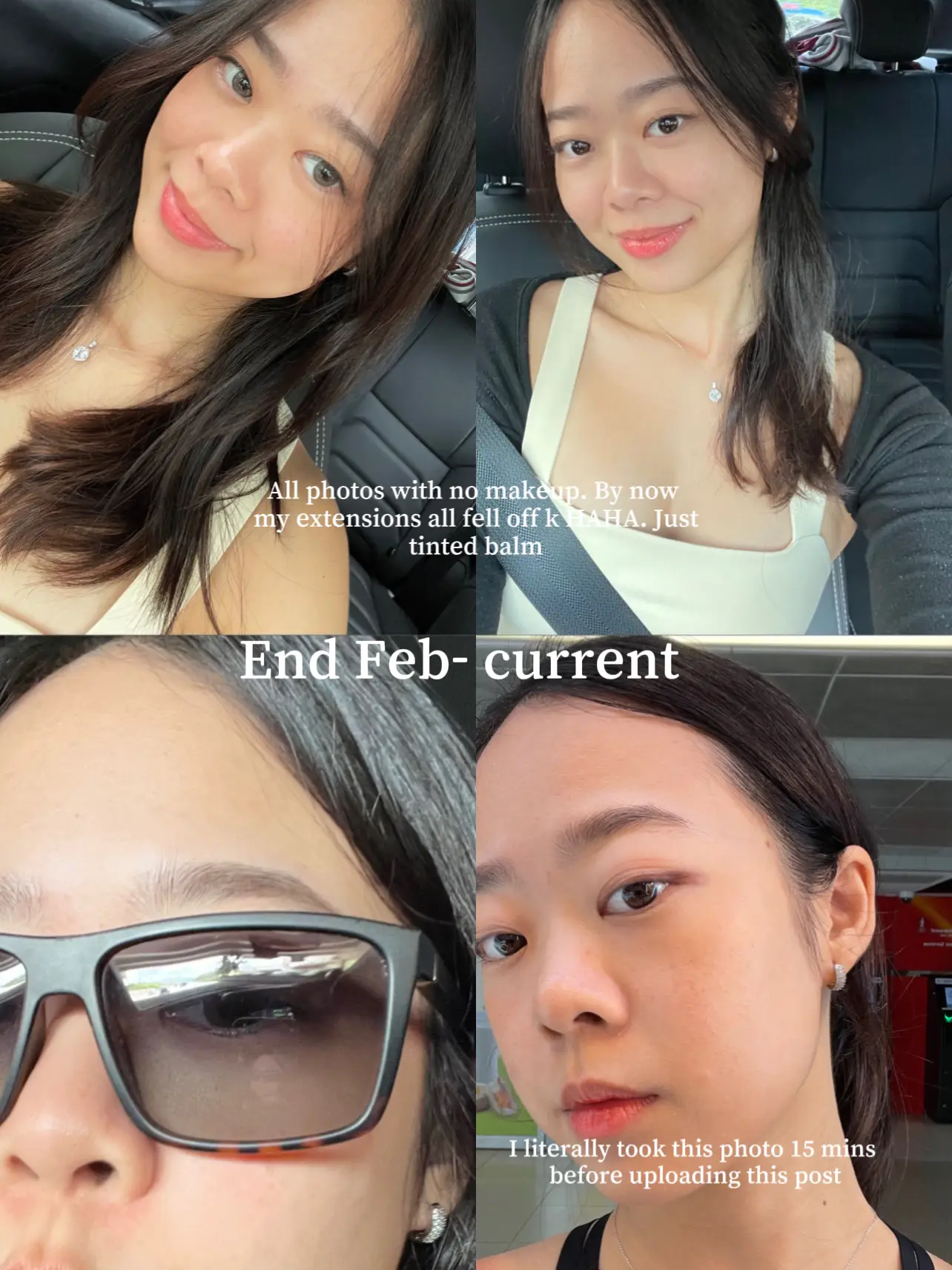 I finally cleared up my acne... 😭🧿's images(3)
