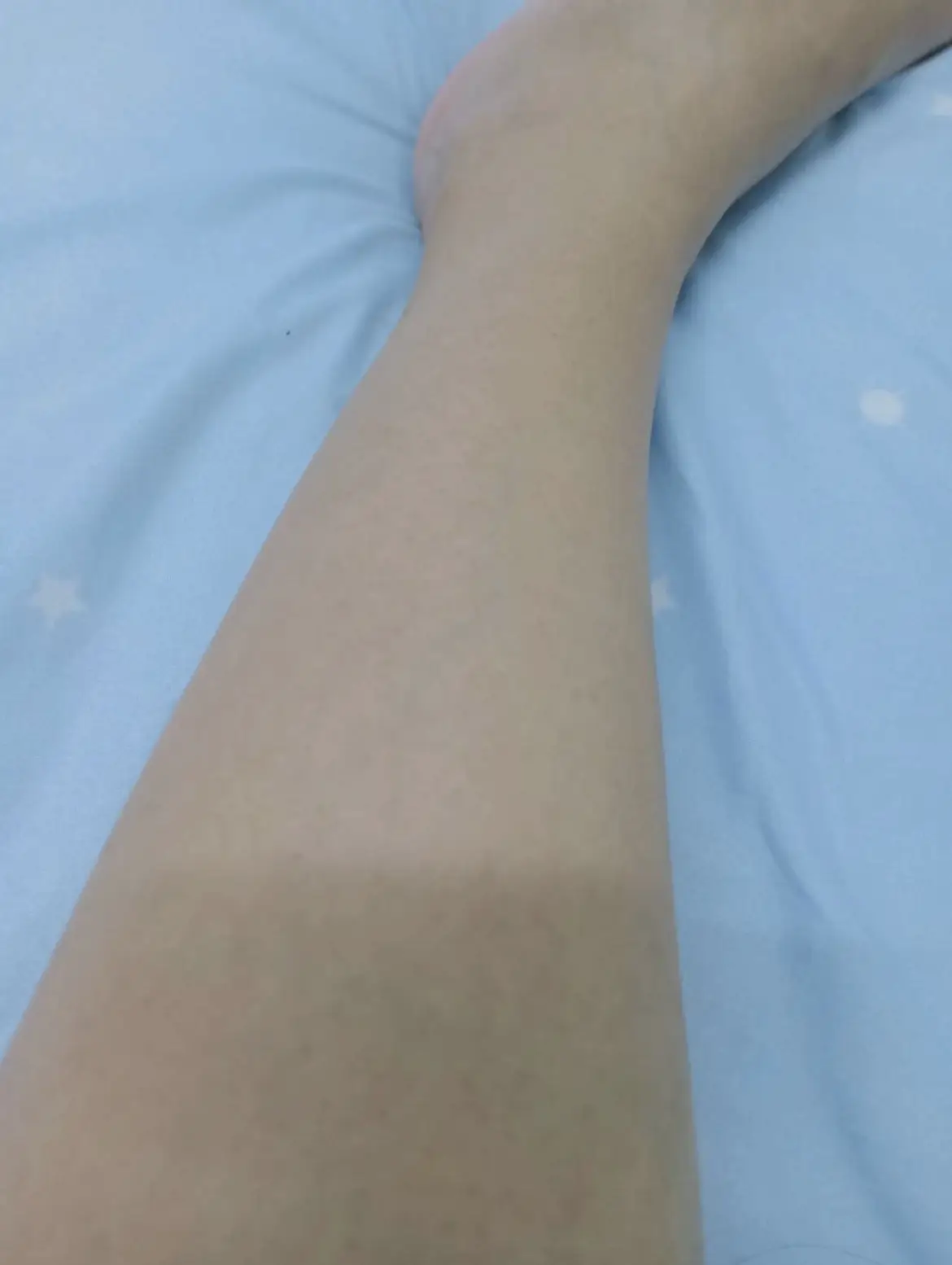 รีวิวครีมกำจัดขน Mimikos Body Hair Remover Cream (Norma แกลเลอรีที่