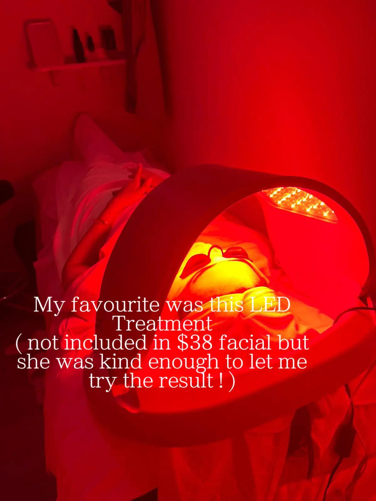Facial for only $38 at CBD area !!'s images(7)
