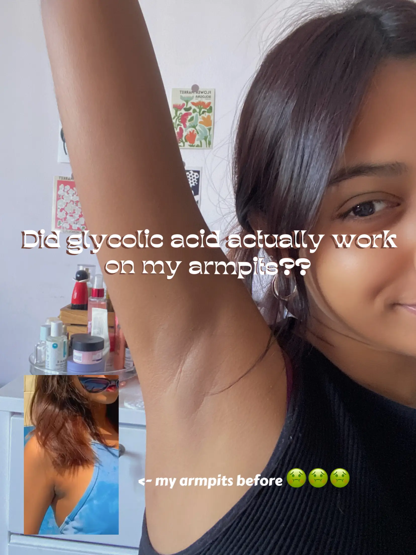 Did glycolic acid really lighten my pits? 's images(0)