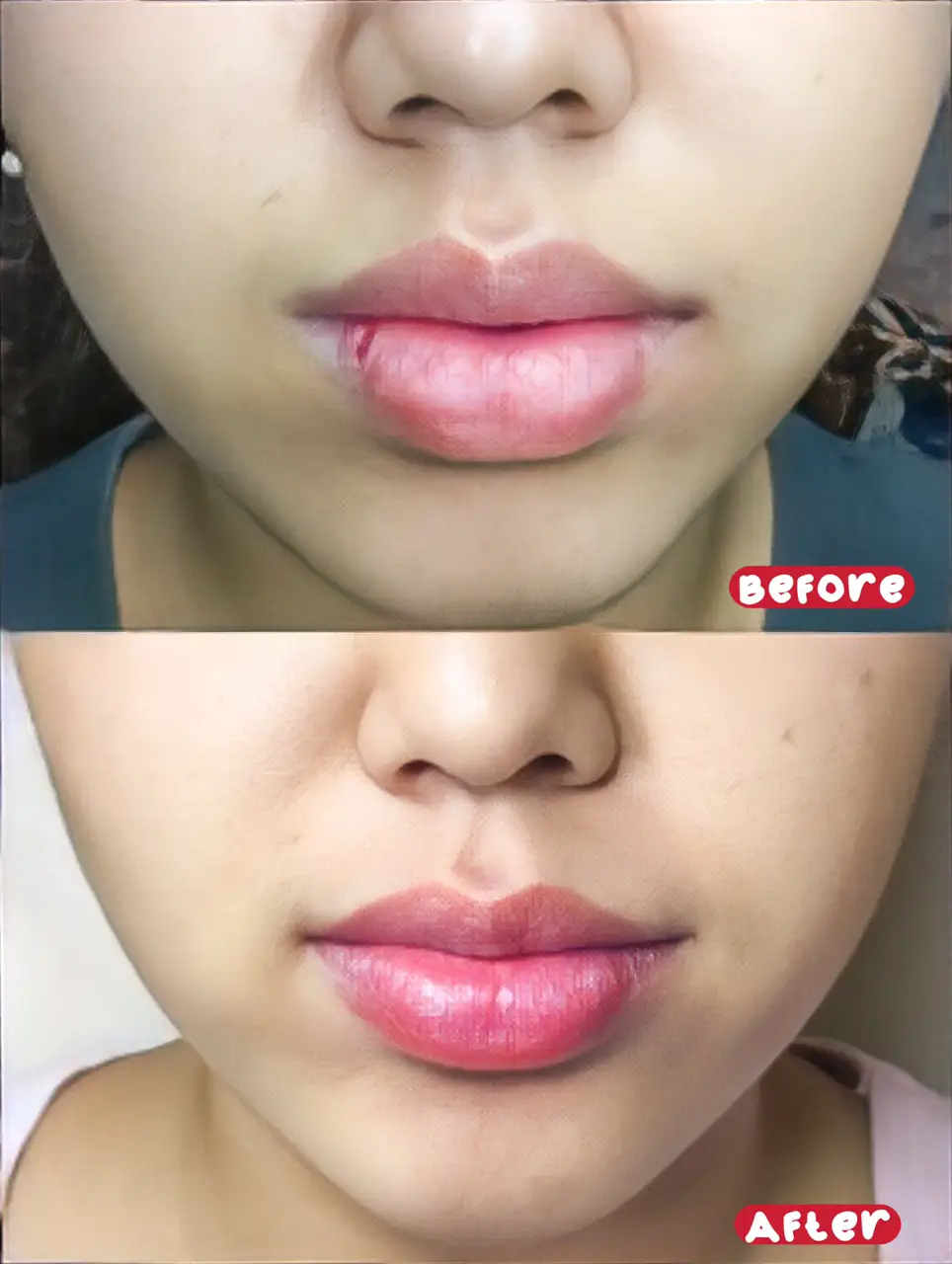 Lip care routine untuk bibir gelap dan kering👄 Galeri diposting oleh