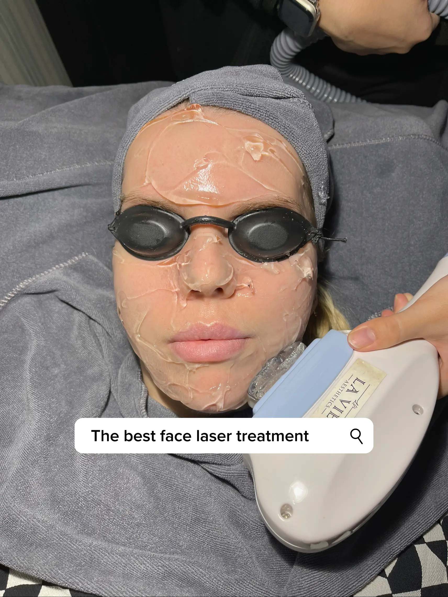 V-Contour Treatment (Face Treatment) - La Vie Aesthetics @ Somerset  Singapore