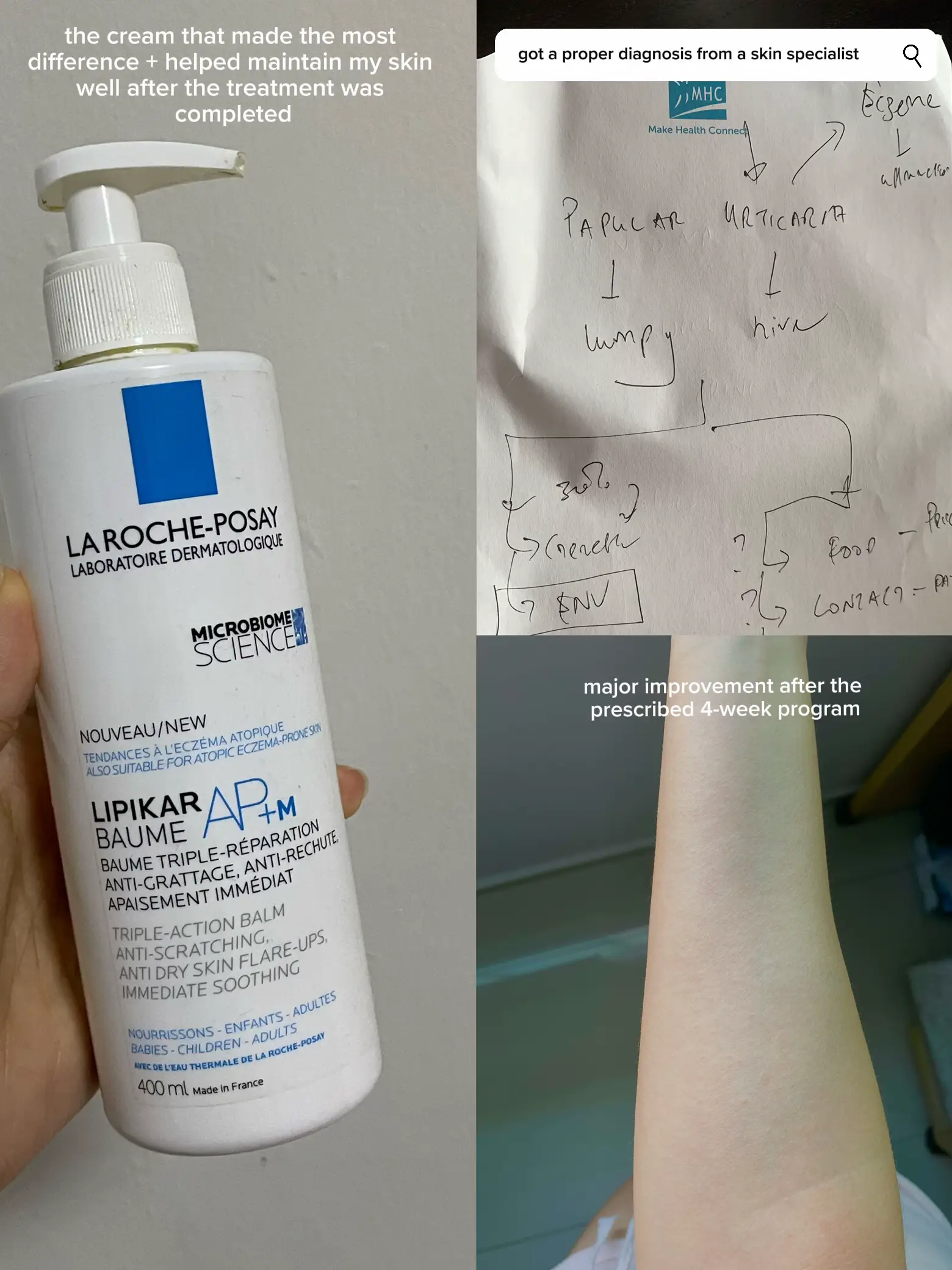 the product that helped my hives/ eczema journey 's images(2)