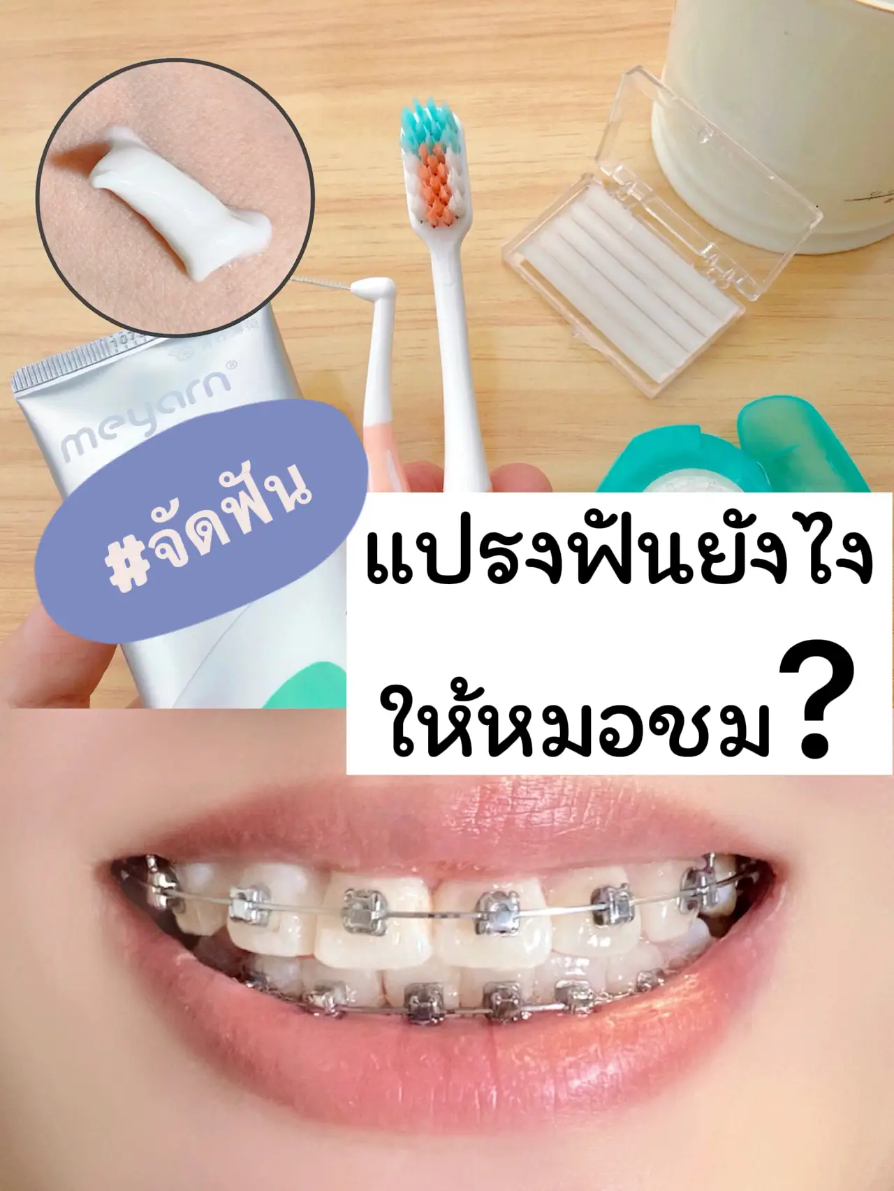 วิธีทำให้ฟันขาว ขึ้น แบบง่ายๆ ด้วยเบกกิ้งโซดา! ทำได้ที่บ้าน | แกลเลอรี ...