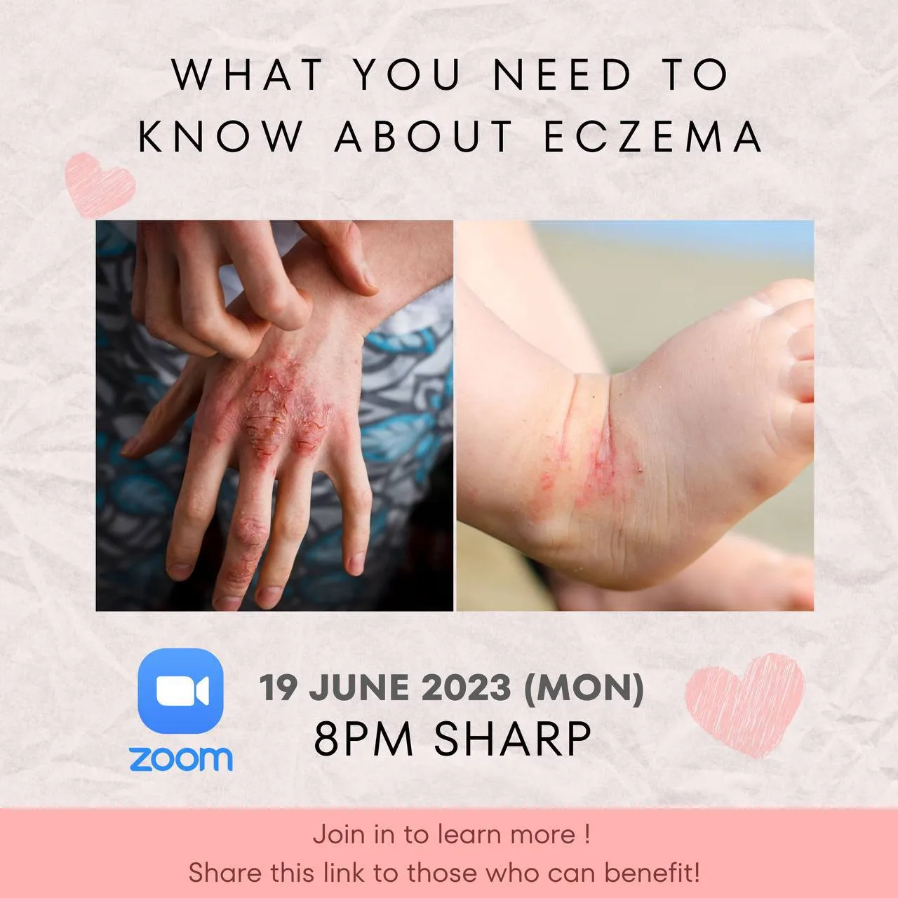 ✨Say Goodbye to Ezcema! ✨'s images