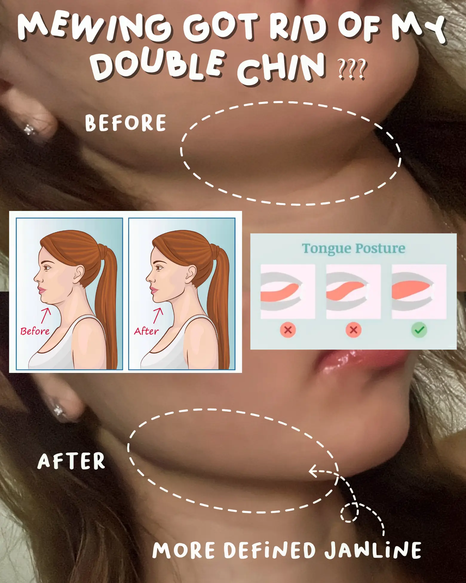 How to get online rid of round chin