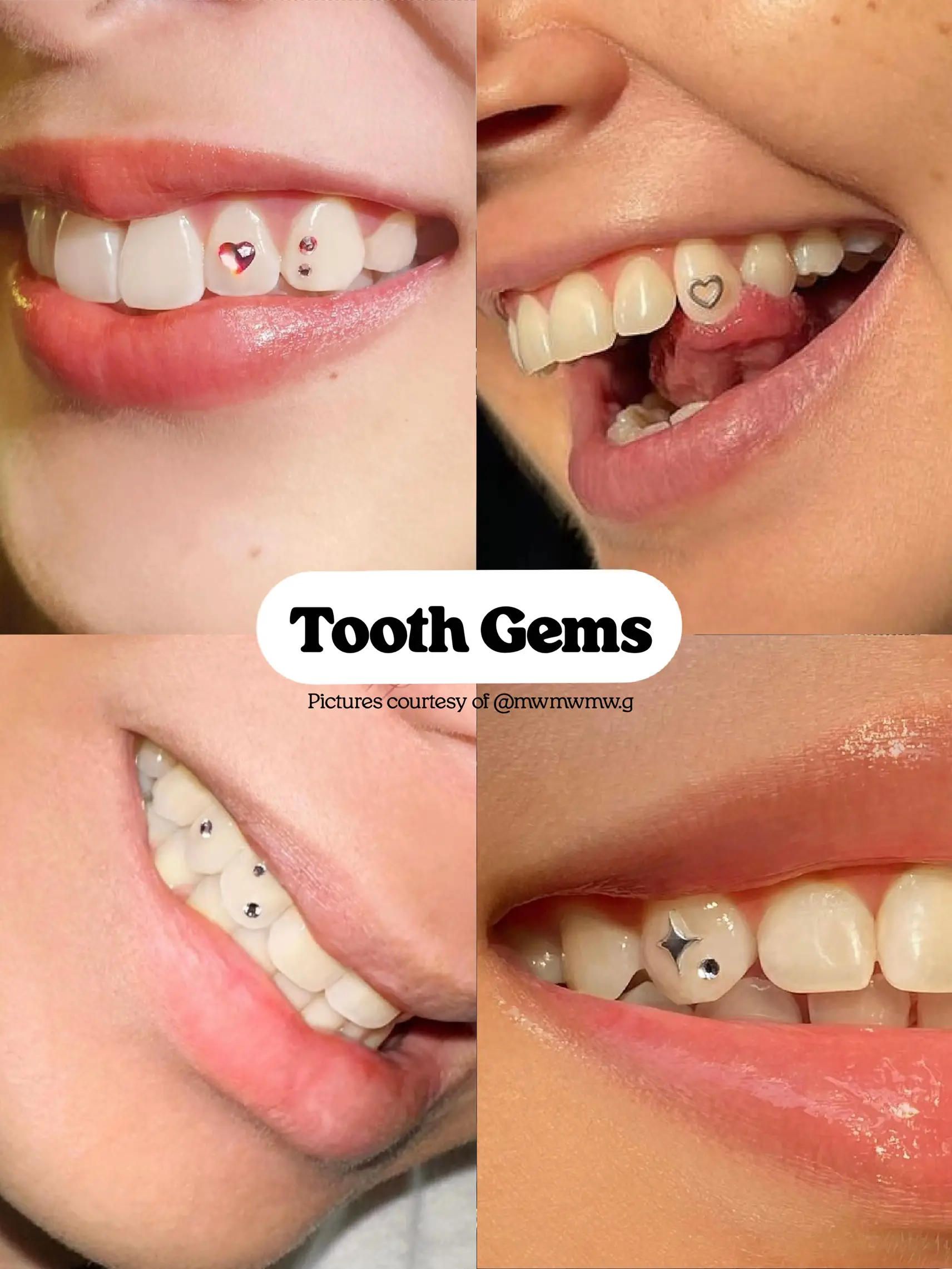 Tooth Gems Swarovski 
