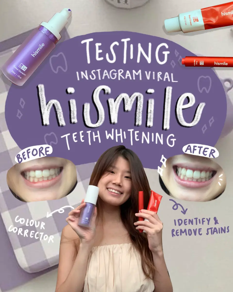 HiSmile teeth whitening – does it really work?