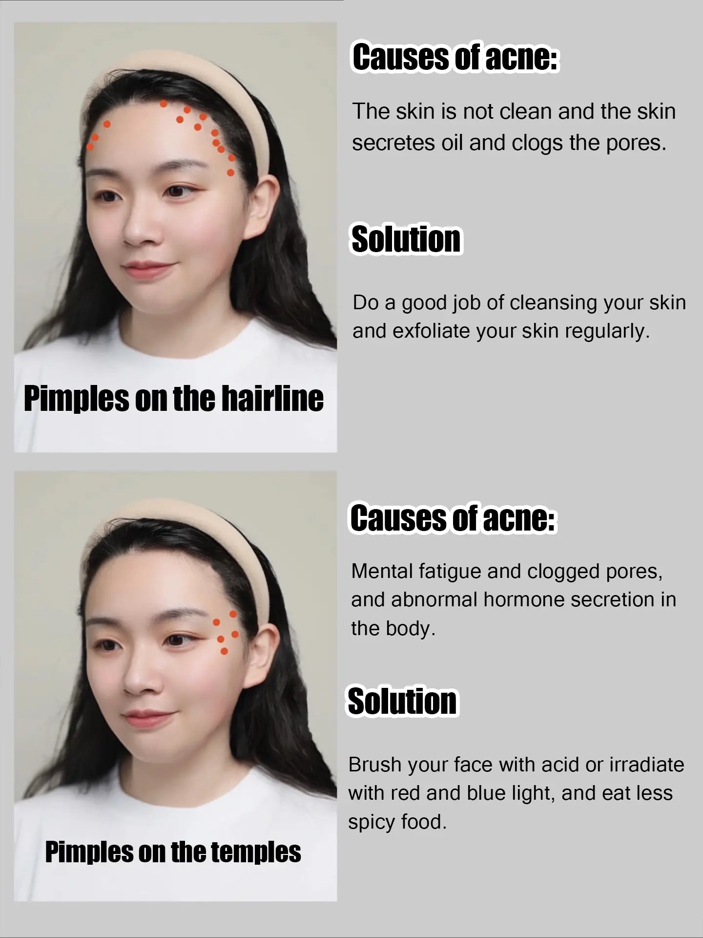 🌼🌼 Skincare routine when you have acne🌼🌼's images(2)