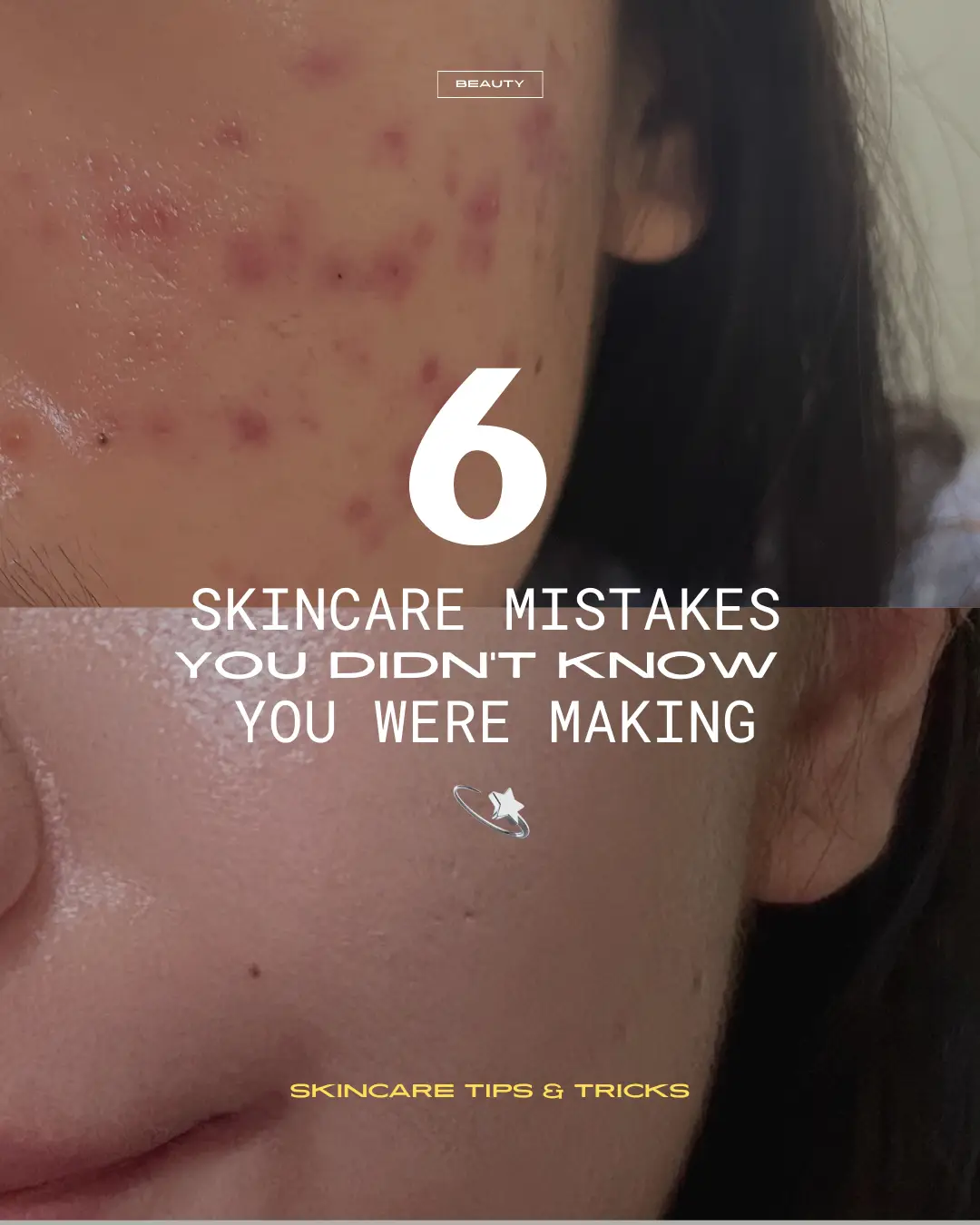 stop making these skincare mistakes 🫵🏼's images(0)